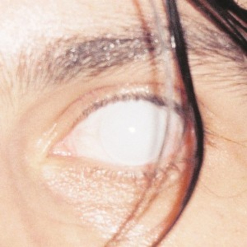 Armlock – Trust (Onyx Marble Vinyl)