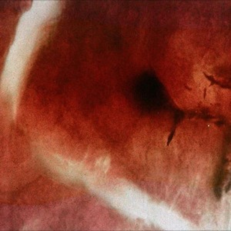 Angles & Elle-Kari with Strings – The Death of Kalypso